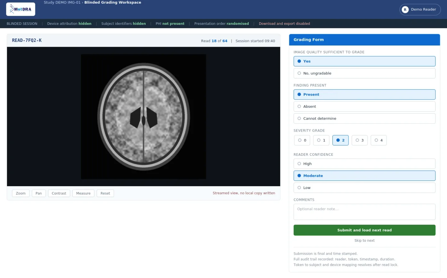 Blinded Grading Workspace, showing a tokenised image with device attribution and subject identifiers hidden, beside the grading form for image quality, finding, severity grade and reader confidence.