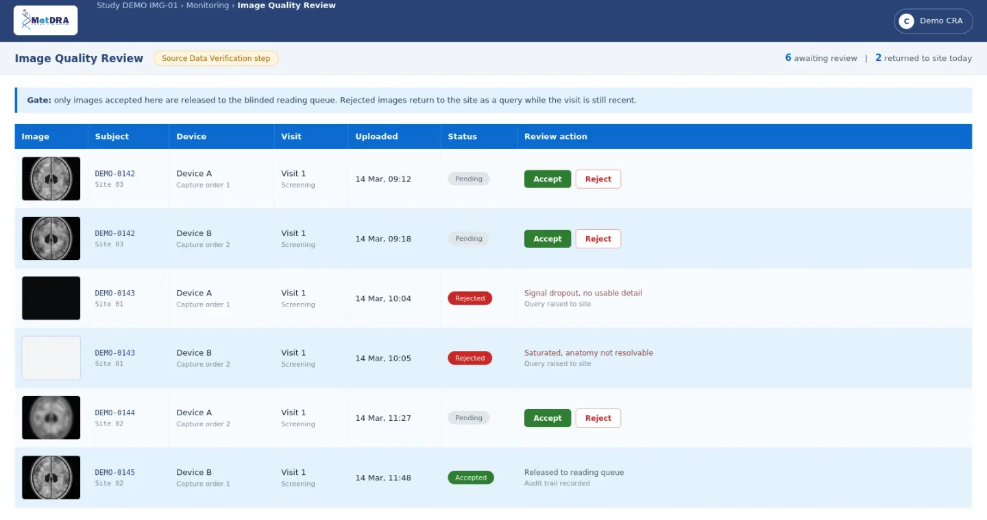 Image Quality Review screen at the source data verification step, where a monitor accepts or rejects each uploaded image before it is released to the blinded reading queue.